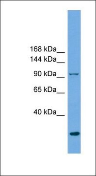 Anti-EXOC1 antibody produced in rabbit affinity isolated antibody