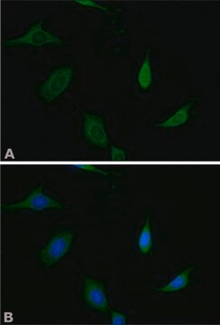 Anti-Munc-18-1 antibody produced in rabbit IgG fraction of antiserum, buffered aqueous solution