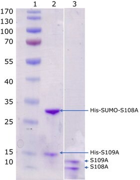 Calprotectin, human recombinant Stabilized heterodimer of fusion tagged S100A9 and S100A8