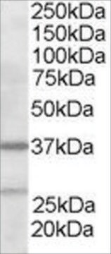 抗ARP2/3サブユニット1B抗体 ヤギ宿主抗体 affinity isolated antibody, buffered aqueous solution