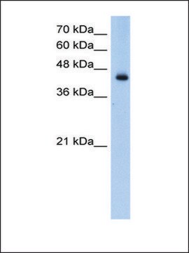 Anti-ACADL antibody produced in rabbit affinity isolated antibody