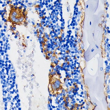 Anti-Integrin beta 3 (ITGB3/CD61) Antibody, clone 7D5N1, Rabbit Monoclonal