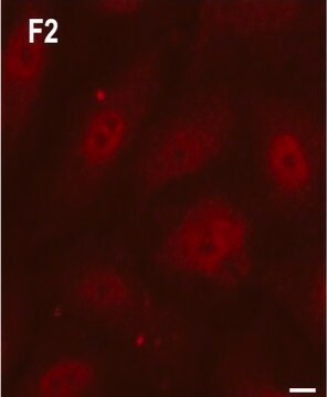 抗-Rab5抗体，小鼠单克隆 clone Rab5-65, purified from hybridoma cell culture