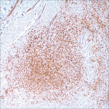 Beta-Catenin (14) Mouse Monoclonal Antibody