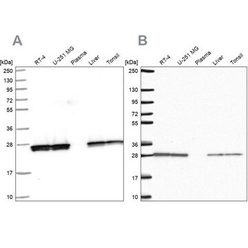 抗TPI1抗体 ウサギ宿主抗体 Prestige Antibodies&#174; Powered by Atlas Antibodies, affinity isolated antibody