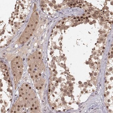 Anti-CSNK2A1 antibody produced in rabbit Prestige Antibodies&#174; Powered by Atlas Antibodies, affinity isolated antibody