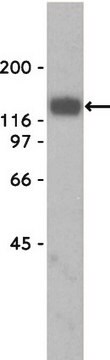 Anti-&#945;-Dystroglycan-Antikörper, Klon VIA4-1 culture supernatant, clone VIA4-1, Upstate&#174;