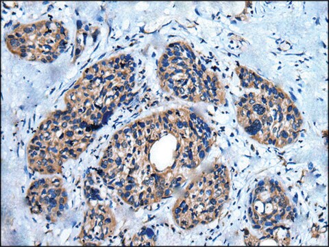 Anti-UNC5A affinity isolated antibody