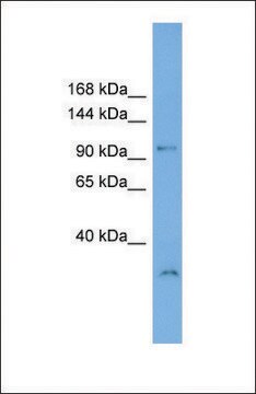 Anti-DENND1A antibody produced in rabbit affinity isolated antibody