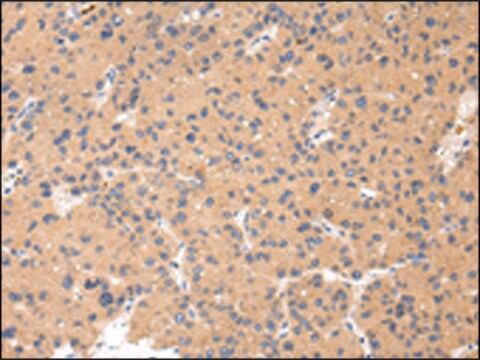 Anti-CTSK affinity isolated antibody