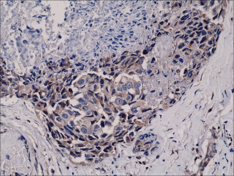 抗-Phospho-akt (ser473)抗体、ウサギモノクローナル recombinant, expressed in HEK 293 cells, clone RM251, purified immunoglobulin