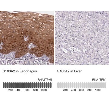 Anti-S100A2 antibody produced in rabbit Prestige Antibodies&#174; Powered by Atlas Antibodies, affinity isolated antibody, buffered aqueous glycerol solution