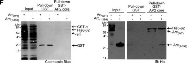 モノクローナル抗ポリヒスチジン抗体 マウス宿主抗体 clone HIS-1, ascites fluid