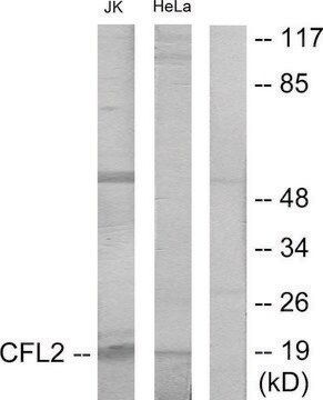 抗コフィリン ウサギ宿主抗体 affinity isolated antibody