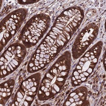 Anti-TSR3 antibody produced in rabbit Prestige Antibodies&#174; Powered by Atlas Antibodies, affinity isolated antibody, buffered aqueous glycerol solution