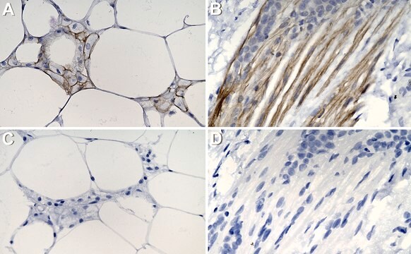 Anti-SUCNR1/GPR91 Antibody, clone 1N21 ZooMAb&#174; Rabbit Monoclonal recombinant, expressed in HEK 293 cells