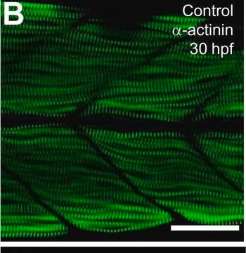 Anti-&#945;-actinina (sarcomérica) monoclonal antibody produced in mouse clone EA-53, ascites fluid