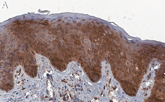 Anti-Cytokeratin-17 Antibody, clone 2K20 ZooMAb&#174; Rabbit Monoclonal recombinant, expressed in HEK 293 cells