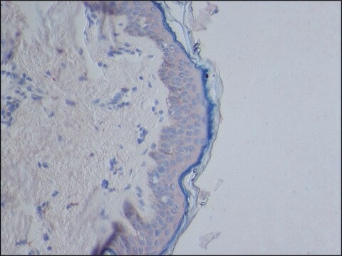 Anti-CYLD (C-terminal) antibody produced in rabbit ~1.0&#160;mg/mL, affinity isolated antibody