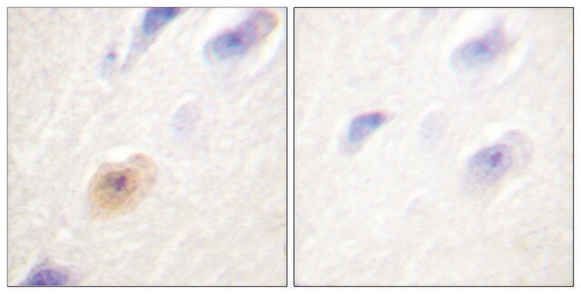 Anti-CSE1L antibody produced in rabbit affinity isolated antibody