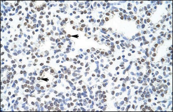 Anti-POGZ antibody produced in rabbit IgG fraction of antiserum