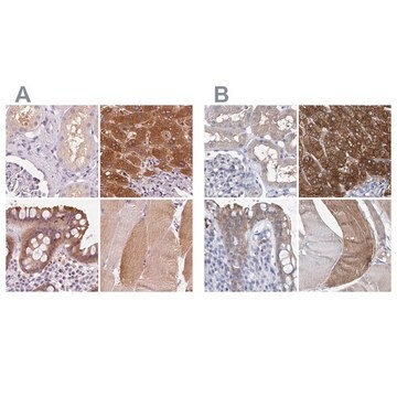 Anti-UGP2 antibody produced in rabbit Prestige Antibodies&#174; Powered by Atlas Antibodies, affinity isolated antibody, buffered aqueous glycerol solution