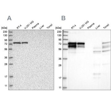 Anti-PPP2R5D antibody produced in rabbit Prestige Antibodies&#174; Powered by Atlas Antibodies, affinity isolated antibody, buffered aqueous glycerol solution, ab2