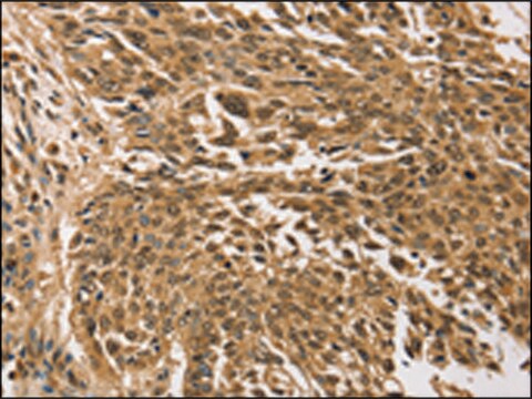 Anti-TGM7 affinity isolated antibody