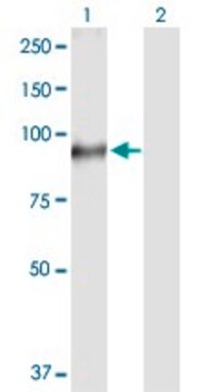 抗TGM1抗体 ウサギ宿主抗体 purified immunoglobulin, buffered aqueous solution