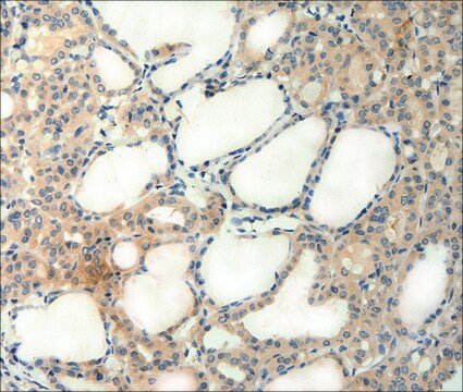 Anti-AGRN antibody produced in rabbit affinity isolated antibody