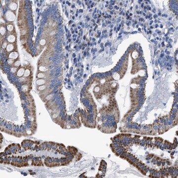 Anti-ZDHHC3 antibody produced in rabbit Prestige Antibodies&#174; Powered by Atlas Antibodies, affinity isolated antibody, buffered aqueous glycerol solution