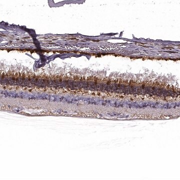 Anti-GUCA1A antibody produced in rabbit Prestige Antibodies&#174; Powered by Atlas Antibodies, affinity isolated antibody