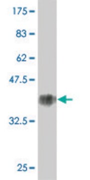 Monoclonal Anti-KRT1 antibody produced in mouse clone 2A7, purified immunoglobulin, buffered aqueous solution