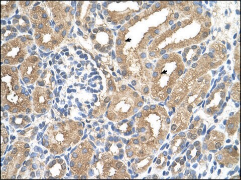 Anti-ADAMTS4 affinity isolated antibody