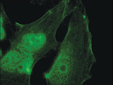 Anti-Palladin (C-terminal) antibody produced in rabbit IgG fraction of antiserum, buffered aqueous solution