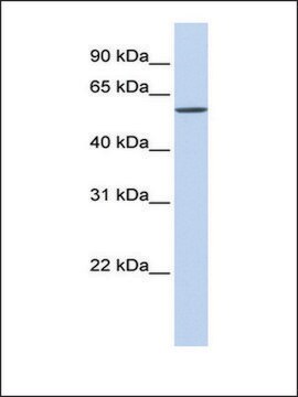 Anti-SLC7A1 antibody produced in rabbit affinity isolated antibody