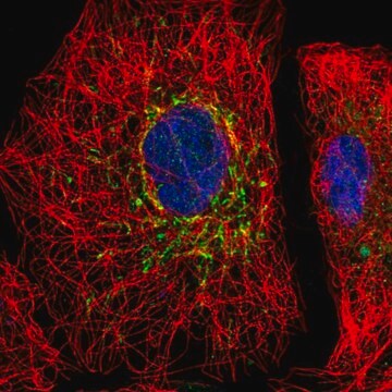 抗SLC25A35抗体 ウサギ宿主抗体 Prestige Antibodies&#174; Powered by Atlas Antibodies, affinity isolated antibody, buffered aqueous glycerol solution