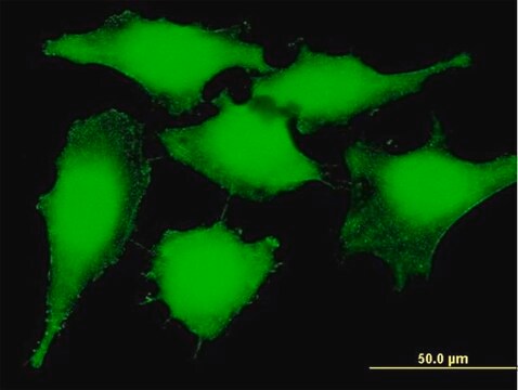 抗PSMB5抗体 マウス宿主抗体 purified immunoglobulin, buffered aqueous solution