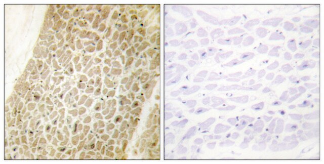 Anti-AKAP8 antibody produced in rabbit affinity isolated antibody