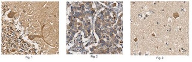 Anti-Equilibrative Nucleoside Transporter 1 Antibody from rabbit, purified by affinity chromatography