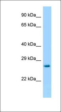 Anti-HPRT antibody produced in rabbit affinity isolated antibody