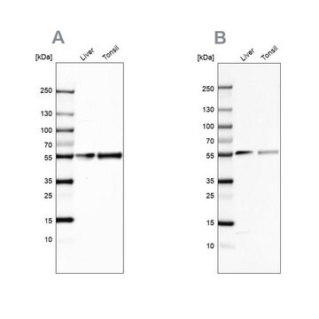 抗-GC 兔抗 Prestige Antibodies&#174; Powered by Atlas Antibodies, affinity isolated antibody, buffered aqueous glycerol solution