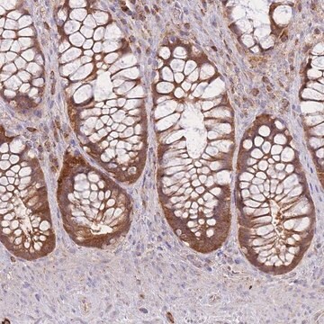 Anti-PREP antibody produced in rabbit Prestige Antibodies&#174; Powered by Atlas Antibodies, affinity isolated antibody, buffered aqueous glycerol solution