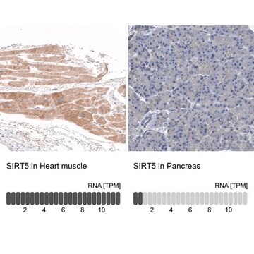 抗SIRT5抗体 ウサギ宿主抗体 Prestige Antibodies&#174; Powered by Atlas Antibodies, affinity isolated antibody, buffered aqueous glycerol solution, Ab1