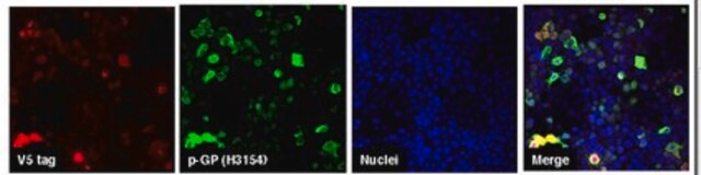 Anticorps anti-C9ORF72/C9RANT (poly-GP sens/antisens) serum, from rabbit