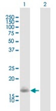 Anti-VSNL1 antibody produced in mouse purified immunoglobulin, buffered aqueous solution