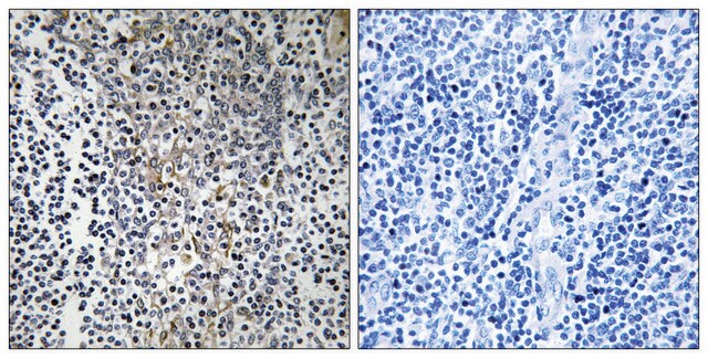 Anti-RPL23 antibody produced in rabbit affinity isolated antibody