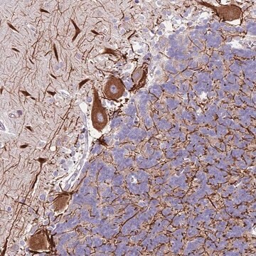 Anti-C2CD3 antibody produced in rabbit Prestige Antibodies&#174; Powered by Atlas Antibodies, affinity isolated antibody, buffered aqueous glycerol solution