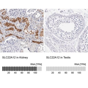 Anti-SLC22A12 antibody produced in rabbit Prestige Antibodies&#174; Powered by Atlas Antibodies, affinity isolated antibody, buffered aqueous glycerol solution