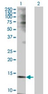 Anti-TSPO antibody produced in rabbit purified immunoglobulin, buffered aqueous solution